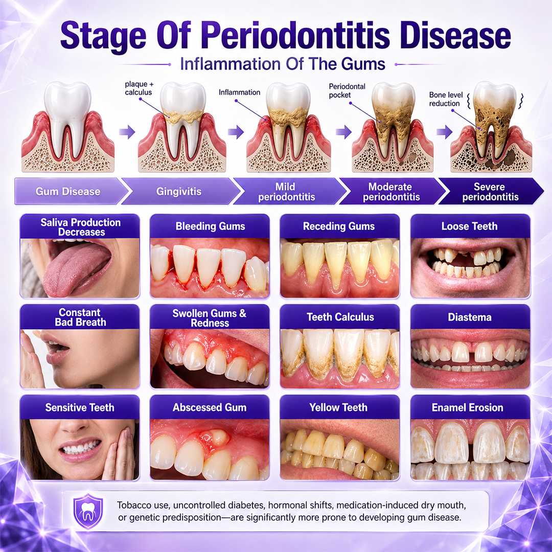 Ceoerty® Gingivitis Periodontal Treatment Toothpaste.