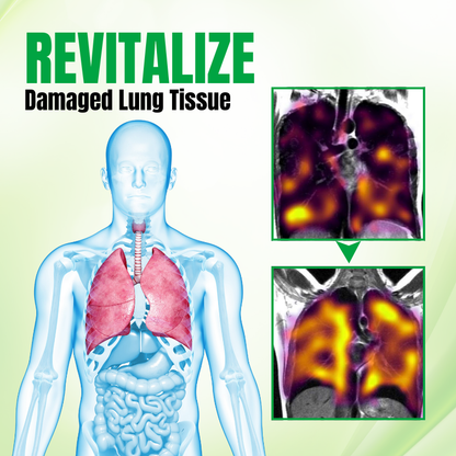 Biancat™ RespiPure Herbal Lung Detox Spray.