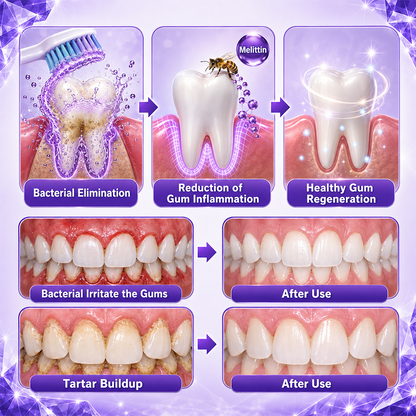 Ceoerty® Gingivitis Periodontal Treatment Toothpaste.